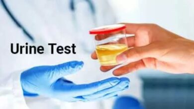 urine test