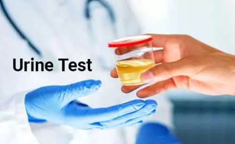 urine test