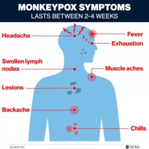 Monkeypox