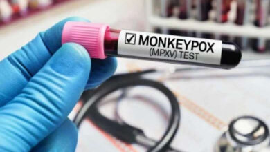 monkeypox