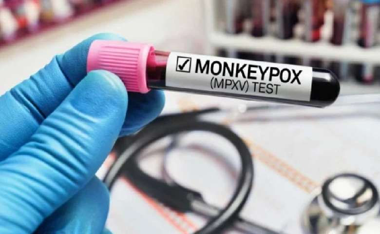 monkeypox