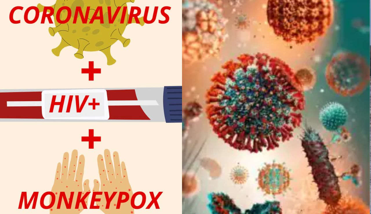 CoronaVirus HIV Monkeypox