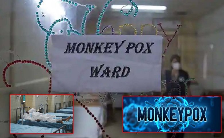 Monkeypox