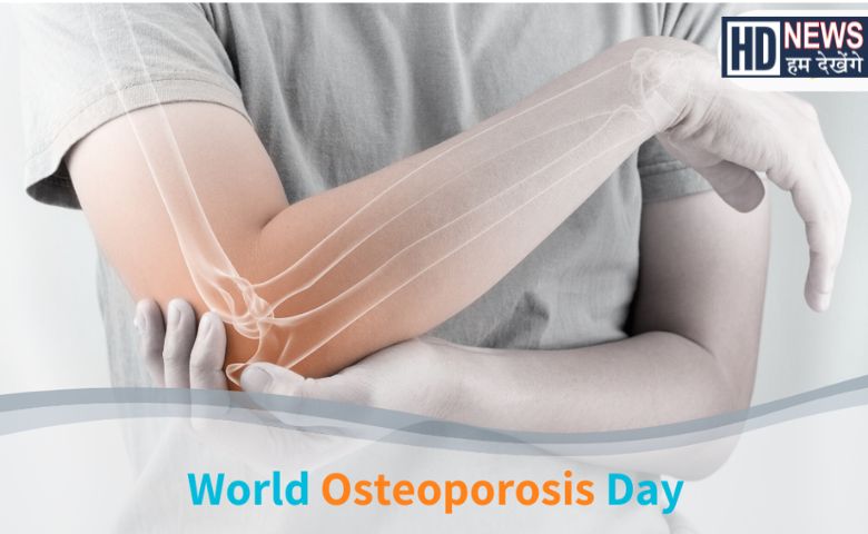 osteoporosis Day - Hum Dekhenge News