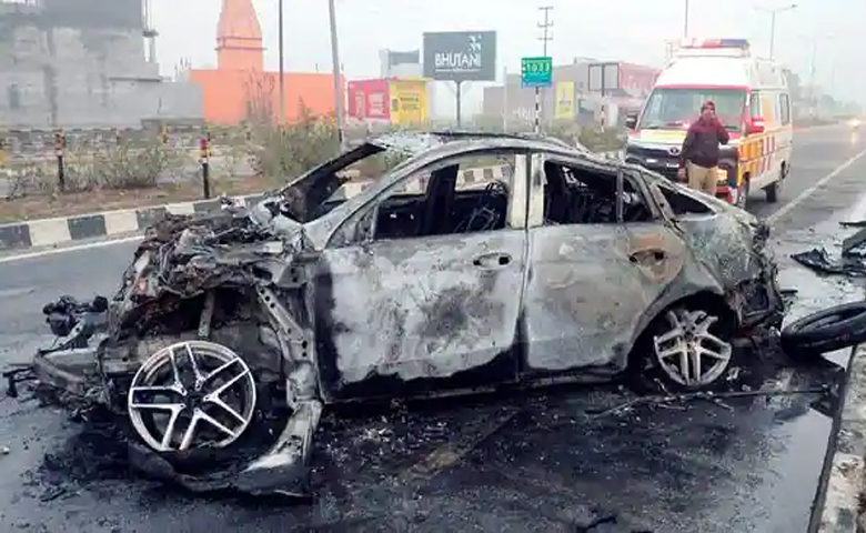 Rishabh Pant Car Burns Image