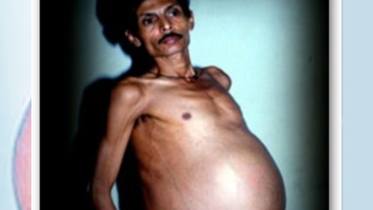 man pregnant